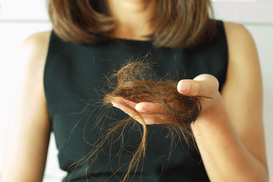 Hair Loss After Weight Loss