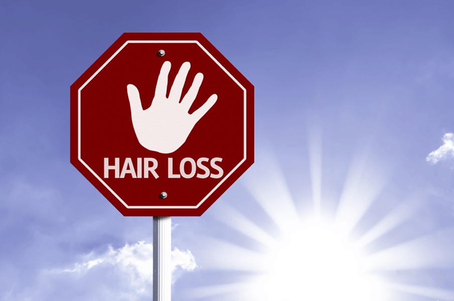 Hair Transplant Sun Exposure